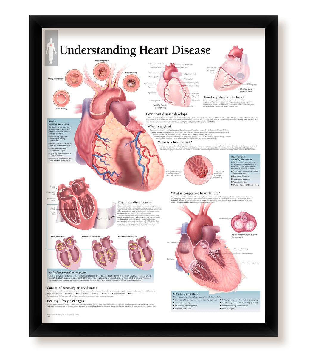 Set of 2 Framed Medical Posters The Heart and Understanding Heart