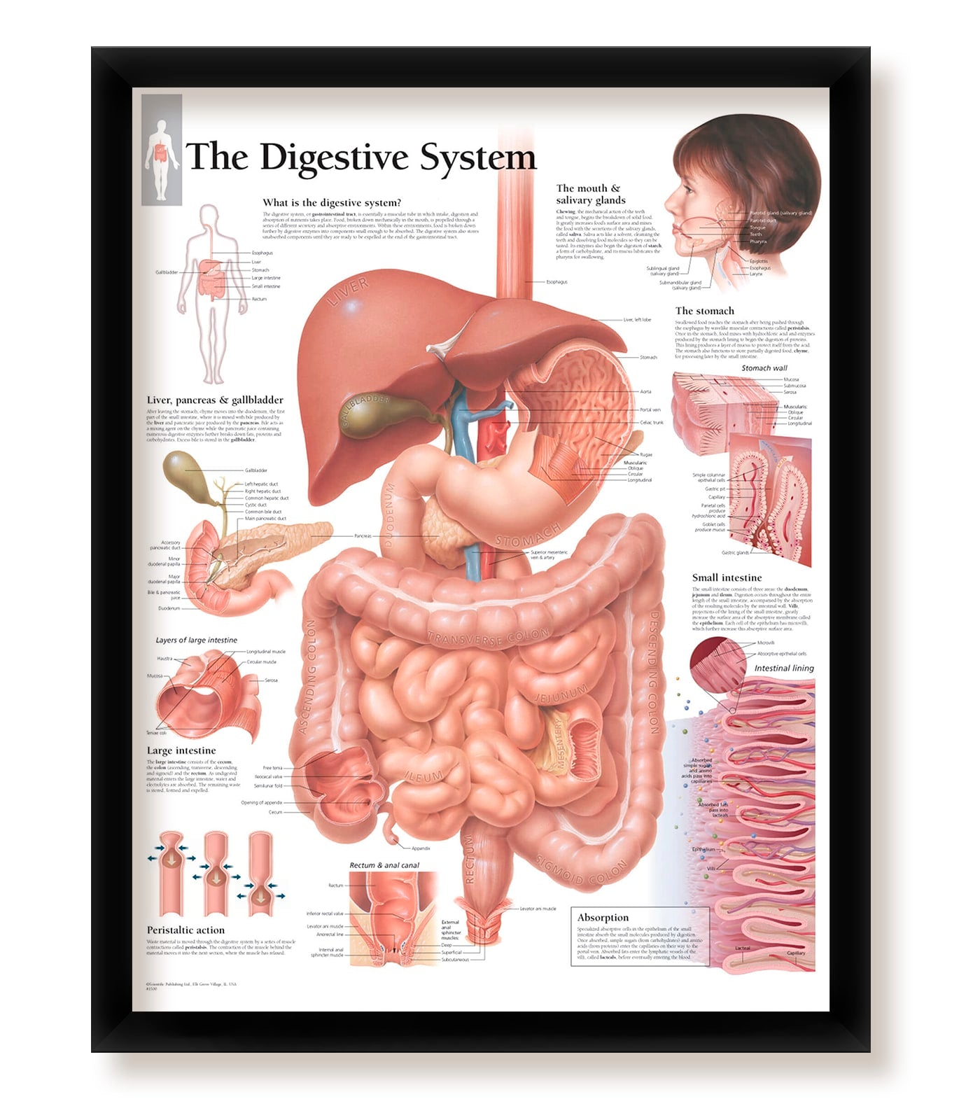 Digestive System Poster Example Set of 4 Framed Medical Posters The Digestive System, Diseases of The ...
