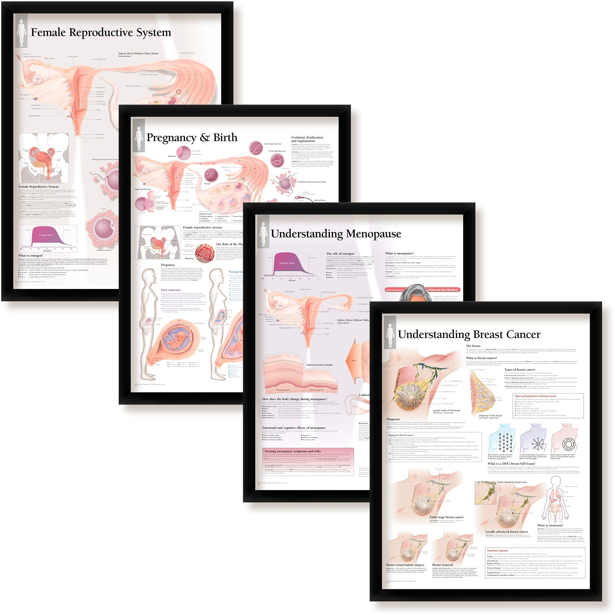 Set of 4 Framed Medical Posters Female Reproductive System Pregnancy a ...